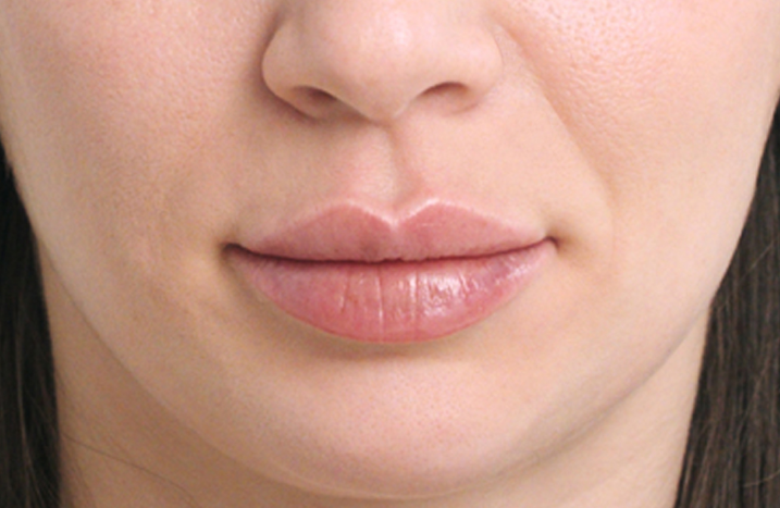 Natural Lip Shapes
